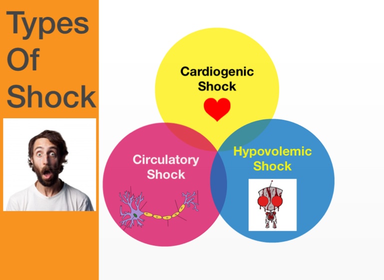 Shock (burns complication) - Screen 2 on FlowVella - Presentation ...