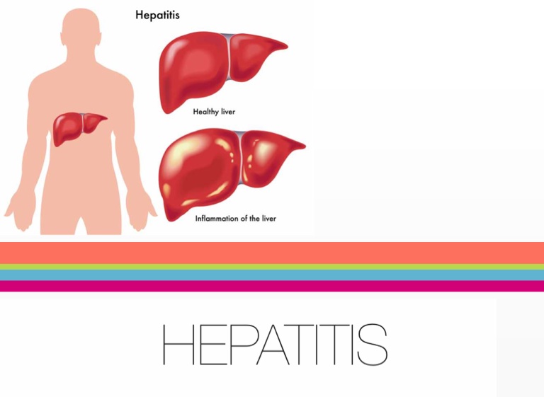 Hepatitis on FlowVella - Presentation Software for Mac iPad and iPhone