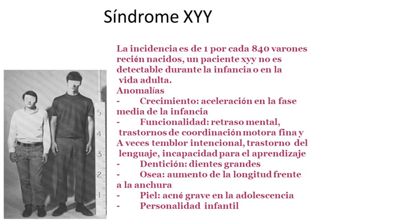 Синдром xyy фото
