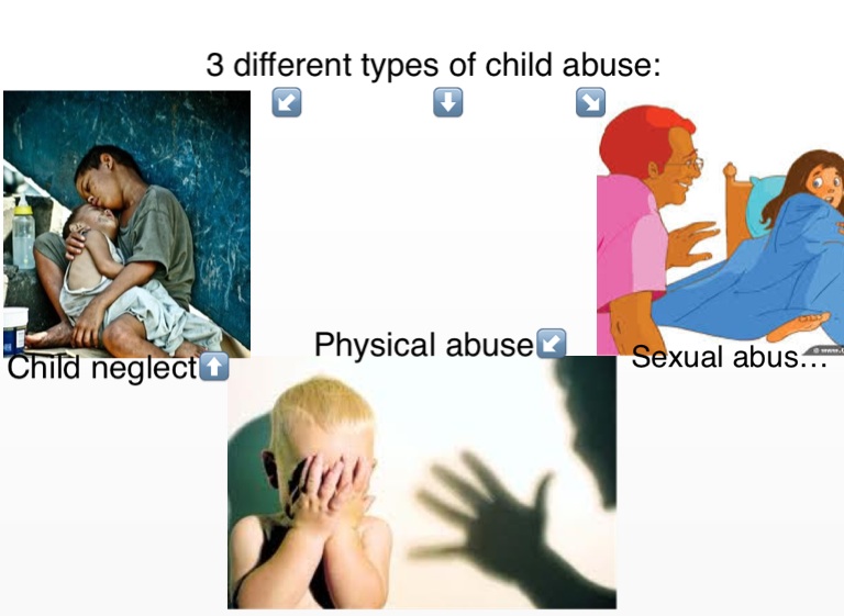 Child abuse are of different types what Child abuse