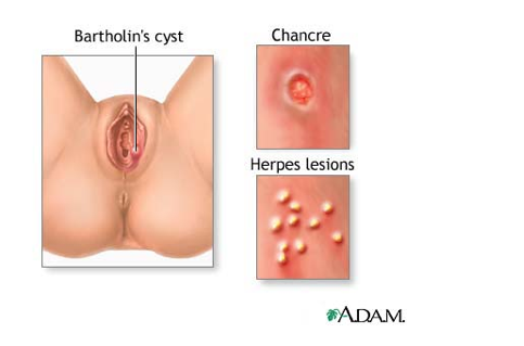 Herpes Screen 8 On Flowvella Presentation Software For Mac Ipad