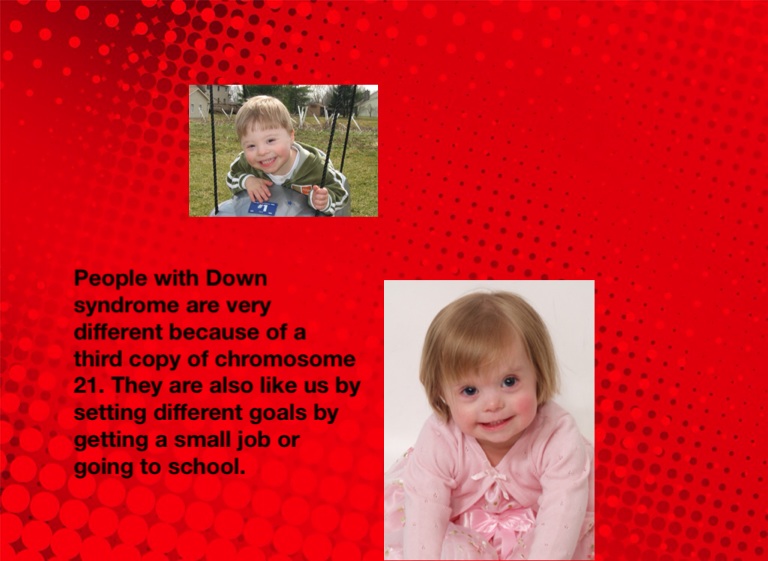 down-syndrome-screen-14-on-flowvella-presentation-software-for-mac