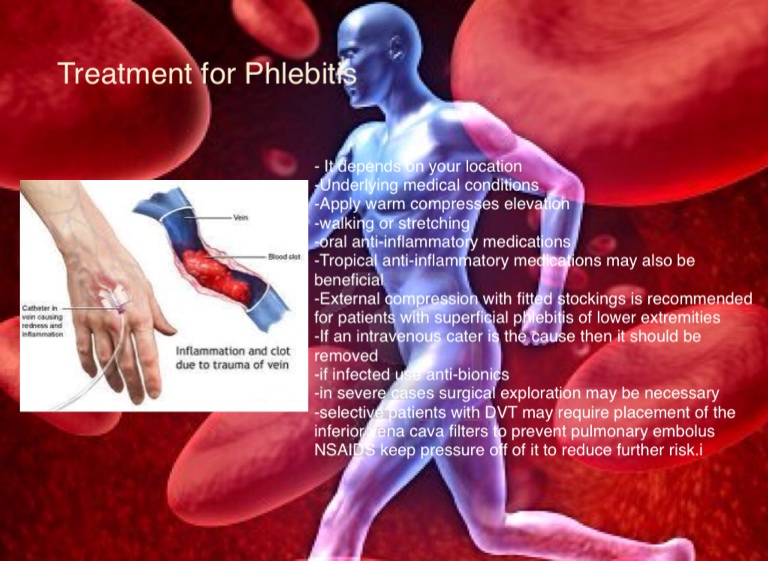 Phlebitis Presentation copy - Screen 6 on FlowVella - Presentation