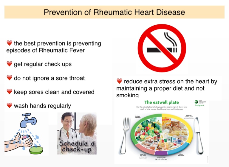 Rheumatic Heart Disease - Screen 9 on FlowVella - Presentation Software