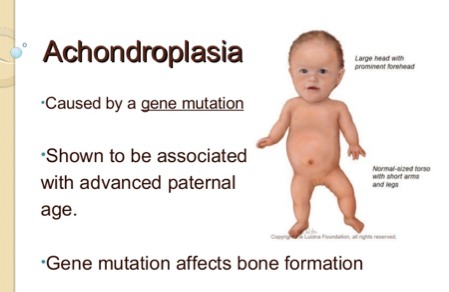 achondroplasia gene mutation