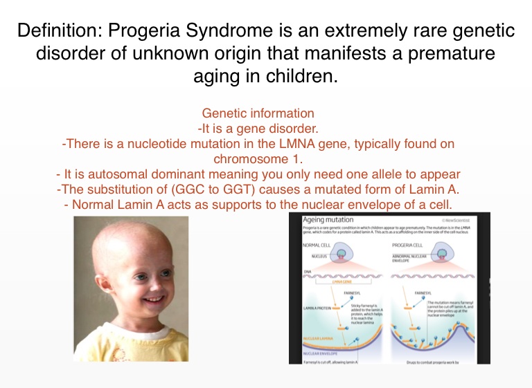 progeria chromosome