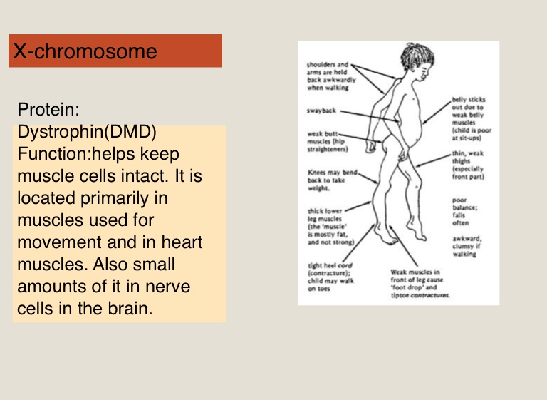 Duchenne Muscular Dystrophy Screen 3 On Flowvella Presentation Software For Mac Ipad And Iphone 4322