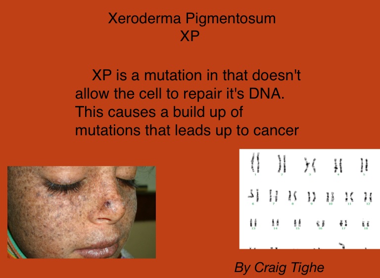 xeroderma pigmentosum pdf