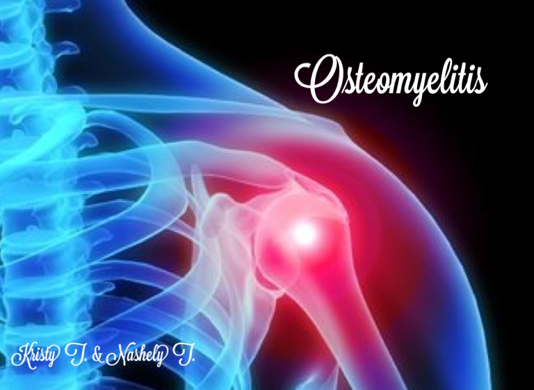 Osteomyelitis on FlowVella Presentation Software for Mac iPad and iPhone