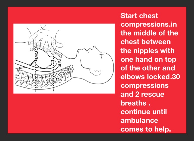 Quick CPR - Screen 6 on FlowVella - Presentation Software for Mac iPad ...