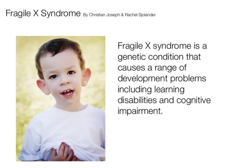 Fragile X Syndrome On Flowvella Presentation Software For Mac Ipad