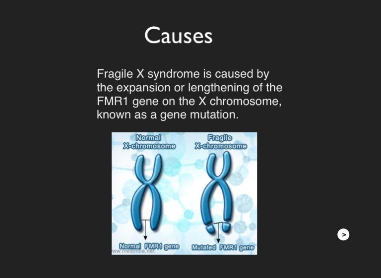 Fragile X Syndrome - Screen 2 on FlowVella - Presentation Software for ...