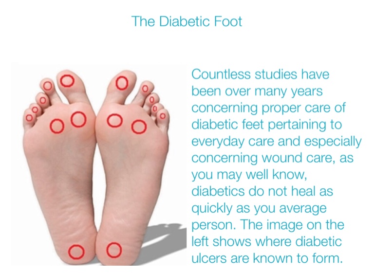 Proper diabetic footcare - Screen 3 on FlowVella - Presentation ...