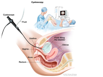 What does a cystoscopy determine?