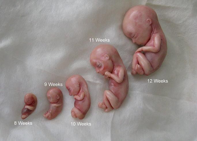 normal heartbeat for 12 week fetus