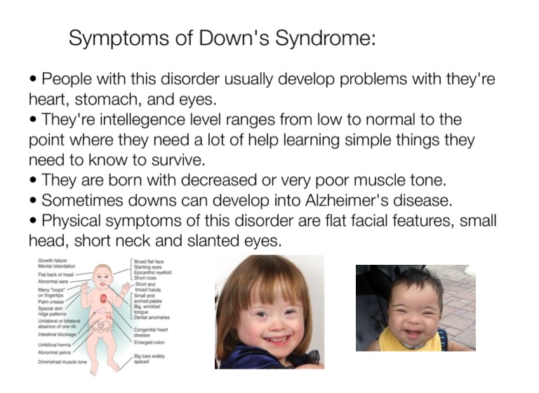 Down's Syndrome - Screen 3 on FlowVella - Presentation Software for Mac ...