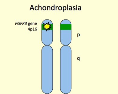 fgfr3 mutation achondroplasia