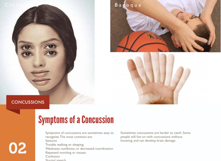 Concussions 101 by Oni Wright Screen 3 on FlowVella Presentation