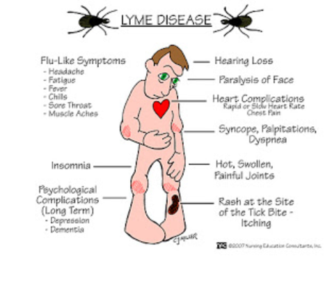 Lyme disease - Screen 9 on FlowVella - Presentation Software for Mac ...