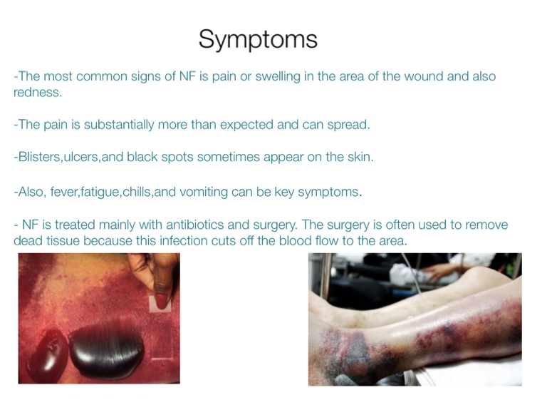 Necrotizing Fasciitis - Screen 4 on FlowVella - Presentation Software ...