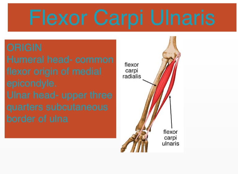 Flexor Carpi Ulnaris - Screen 4 on FlowVella - Presentation Software ...