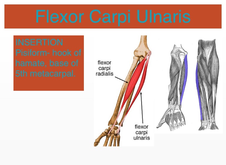 Flexor Carpi Ulnaris Screen 5 On Flowvella Presentation Software For Mac Ipad And Iphone