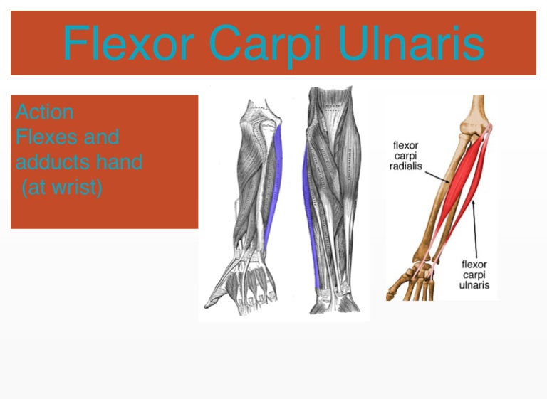 Flexor Carpi Ulnaris Action