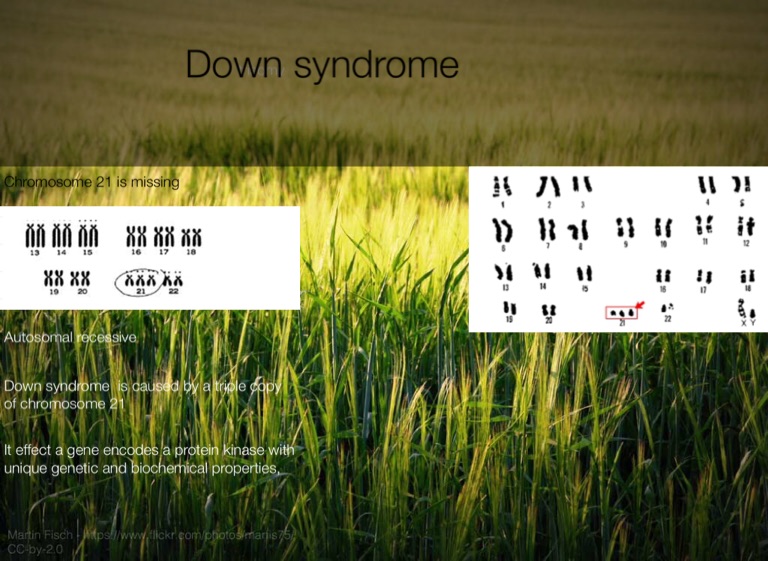 down-syndrome-screen-4-on-flowvella-presentation-software-for-mac