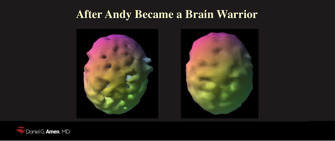 msh brain software mac msh brain software mac