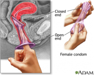 monitoring Deep vaginal