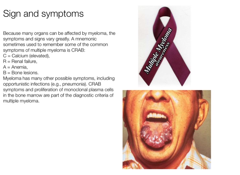 Multiple Myeloma - Screen 9 on FlowVella - Presentation Software for