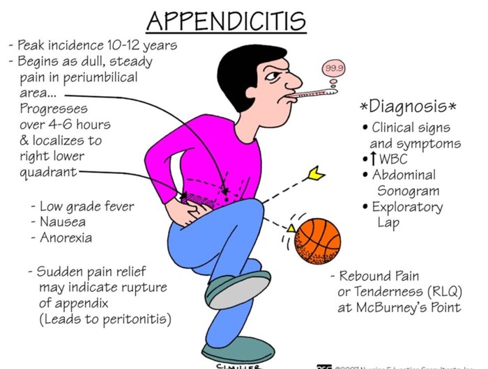 presentation of appendicitis Appendicitis |authorstream.