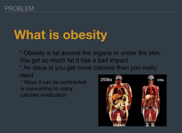 Obesity - Screen 2 on FlowVella - Presentation Software for Mac iPad ...